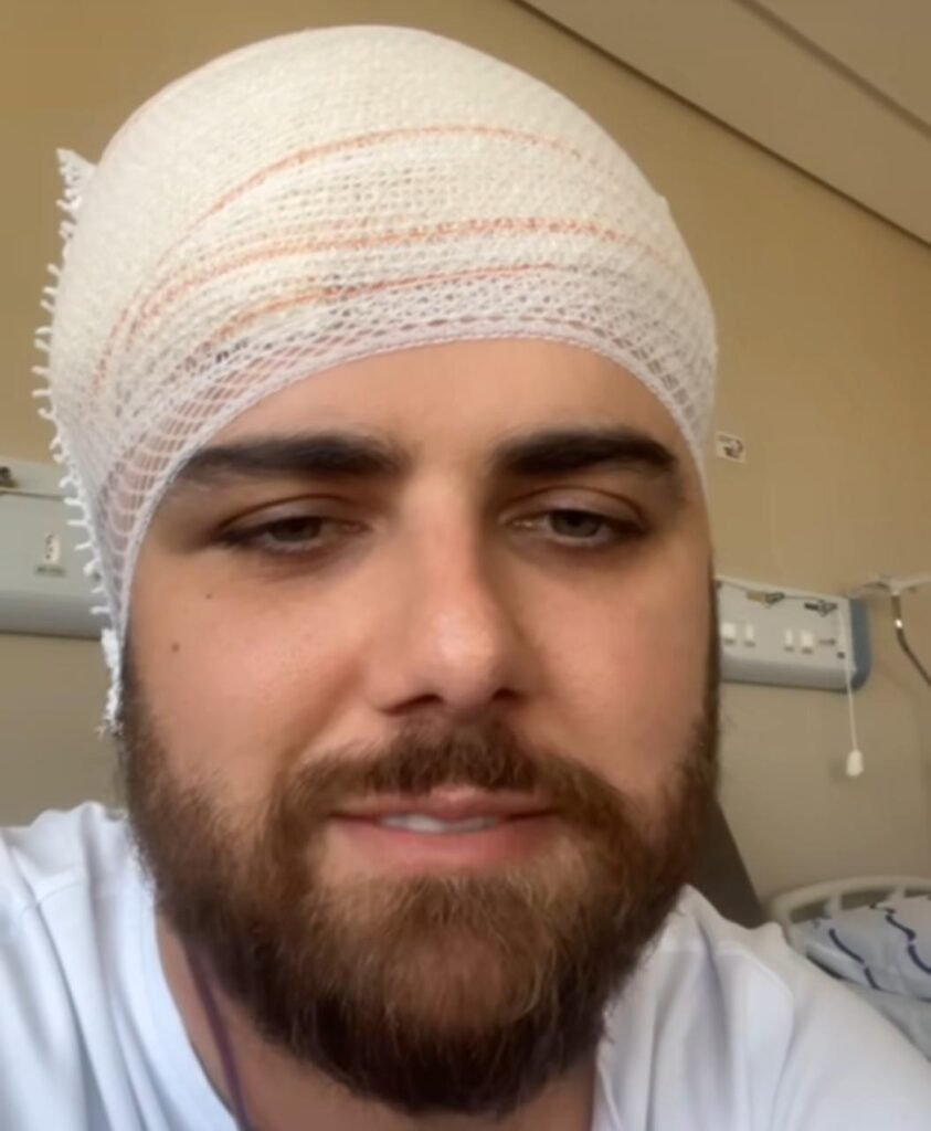 Cantor sofreu um corte na cabeça. (Imagem: Reprodução/Instagram)
